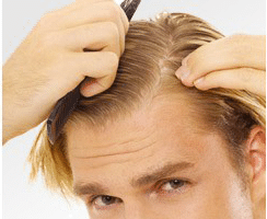 une chute de cheveux une chute de cheveux