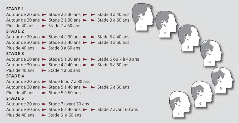 Hamilton scale (alopecia)