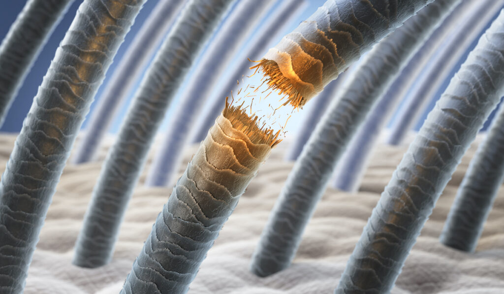 Loss and breakage: when hair goes wrong 2