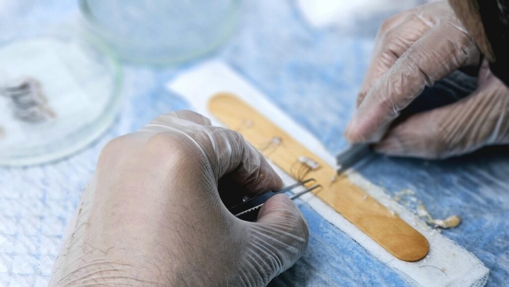Diagnostic capillaire : pour quoi faire? 6